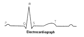 NCERT Exemplar Solutions for Class 11 Biology Chapter 18 Body Fluids and Circulation 1