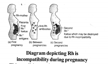 NCERT Exemplar Solutions for Class 11 Biology Chapter 18 Body Fluids and Circulation 5