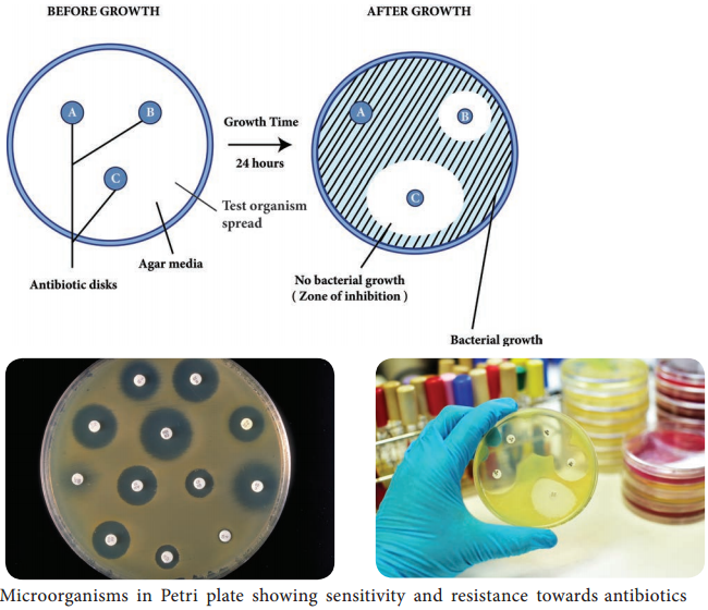 Antimicrobial Susceptibility Testing img 1