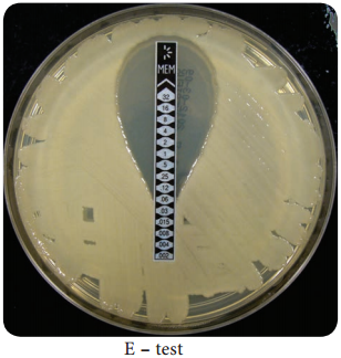 Antimicrobial Susceptibility Testing img 2