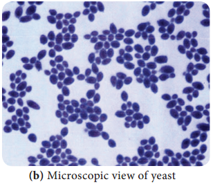 Classification of Fungi based on the Medical Mycology img 1a