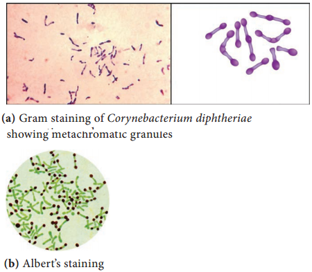 Corynebacterium diphtheriae img 1