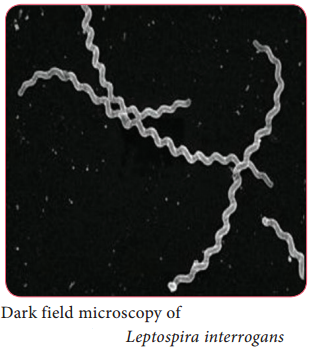 Leptospira Interrogans img 1