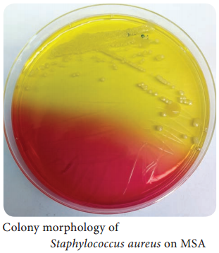 Medical Bacteriology of Staphylococcus aureus img 2