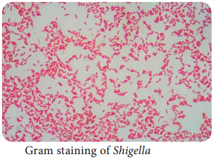 Medical Shigella dysenteriae img 1