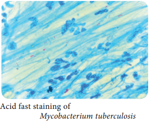 Mycobacterium Tuberculosis (Tubercle Bacillus) img 1