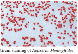 Neisseria meningitidis (Meningococcus) img 2