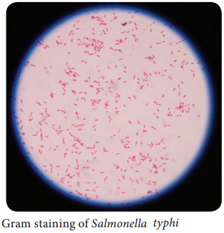 Salmonella typhi of Bacteriology img 1