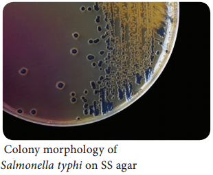 Salmonella typhi of Bacteriology img 3