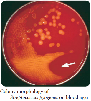 Streptococcus pyogenes (Flesh eating Bacteria) img 2