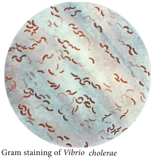 Vibrio cholerae img 1