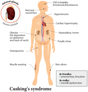 Hypo and Hyper Activity of Endocrine Glands and Related Disorders img 9